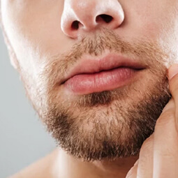 Moustache Transplant for Transmen - 02